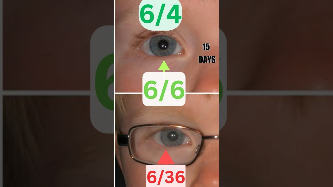 What Are Vitamins And Supplements That Are Great For Your Vision?